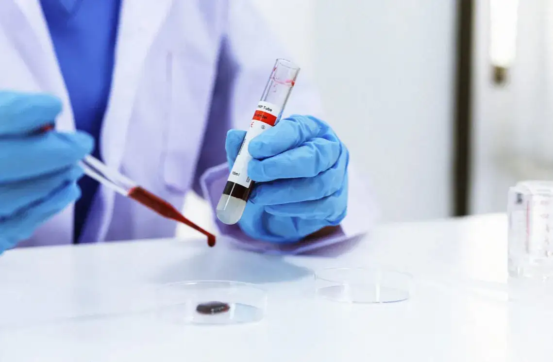 GGTP: Co oznacza Twój wynik? Normy, przyczyny, interpretacja