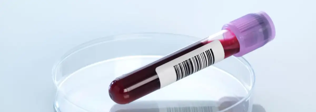 Badanie ANCA: Co to jest? Zrozum wyniki i choroby autoimmunologiczne.