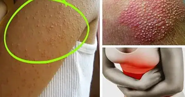 Nietolerancja glutenu i laktozy: objawy, diagnostyka i jak odróżnić