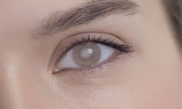 Ile trwa operacja zaćmy? Czas zabiegu i co warto wiedzieć