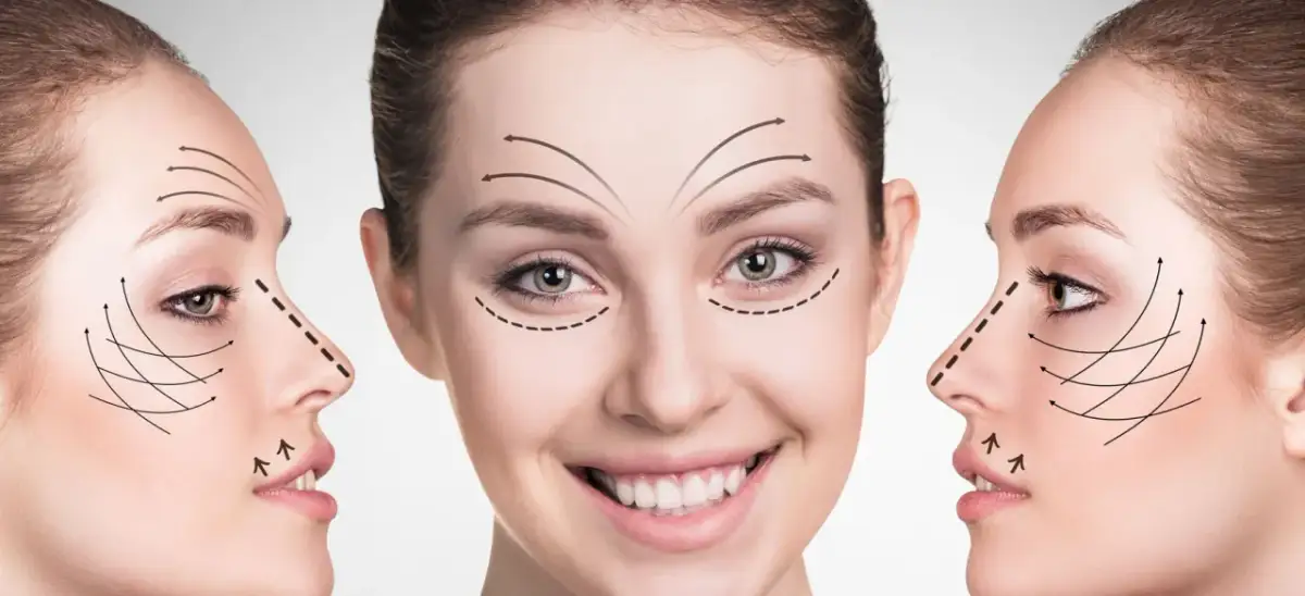 Twarz z zaznaczonymi liniami wskazującymi kierunek liftingu i korekty.