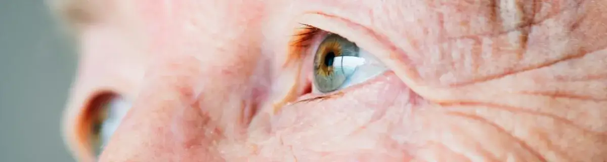 Czy jaskra jest zaraźliwa? Odkryj prawdę o tej chorobie oczu