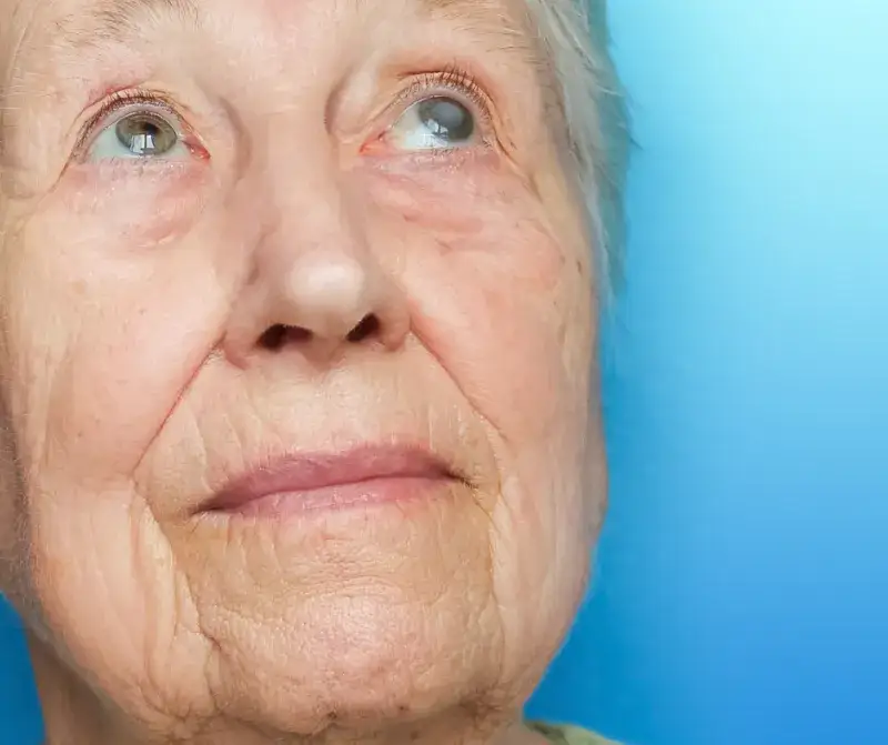 Jak postępować po zabiegu zaćmy, aby uniknąć powikłań i bólu