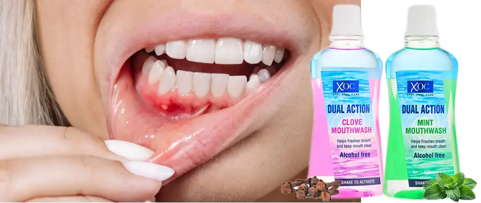 Krwawiące dziąsła: Skuteczne sposoby i leczenie | Poznaj przyczyny