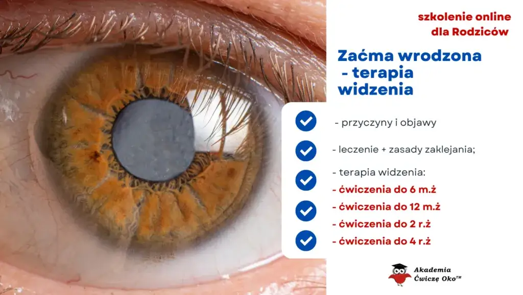 Zaćma wrodzona u dziecka: Objawy, diagnoza, leczenie ratuj wzrok!