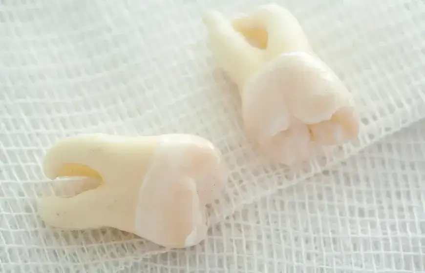 Palenie po dentyście: Uniknij suchego zębodołu! Ile czekać?