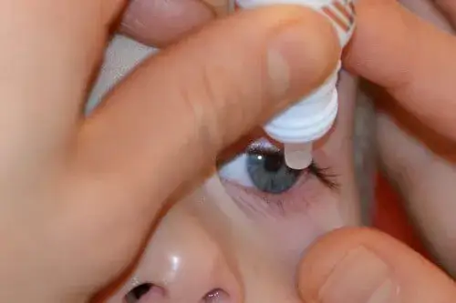 Czy krople do oczu mogą spływać do gardła? Oto, co musisz wiedzieć