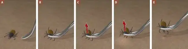 Jak rozpoznać kleszcza i co zrobić? Przewodnik krok po kroku