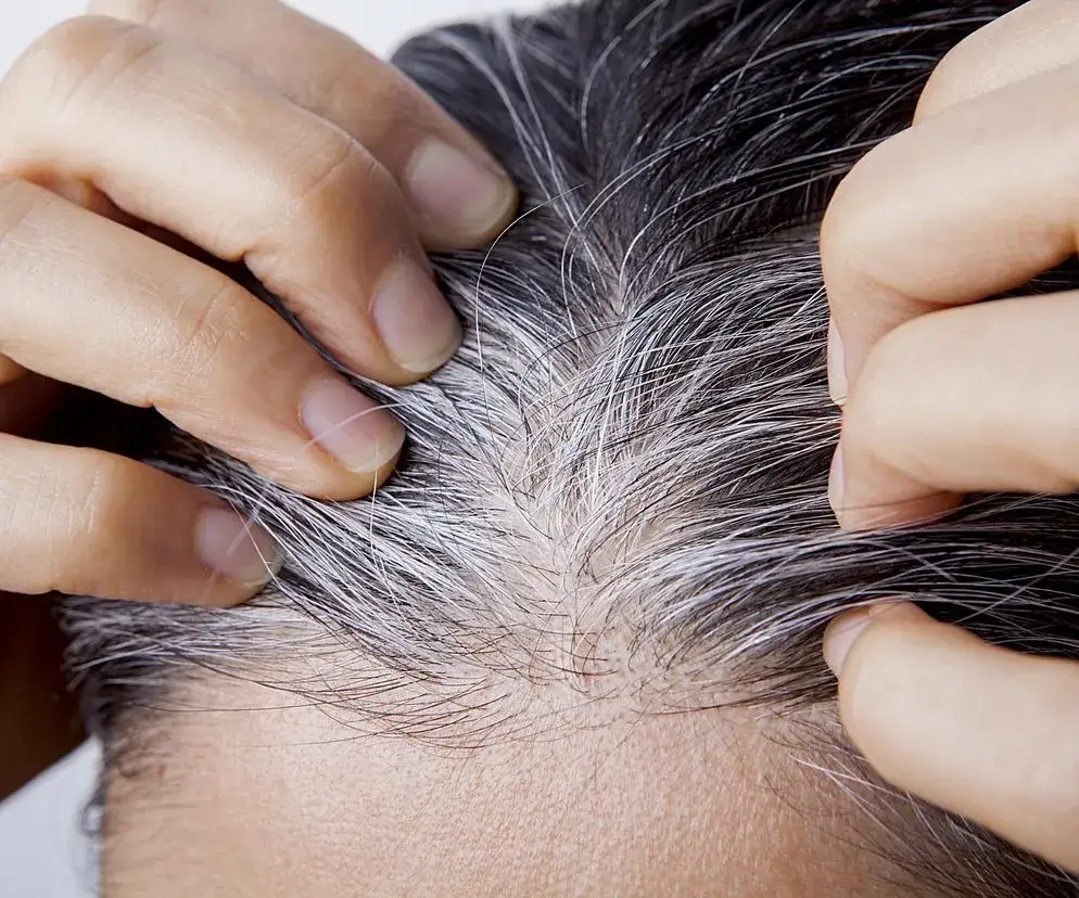Jak zapobiec siwieniu włosów? Ekspert radzi, czy można je cofnąć