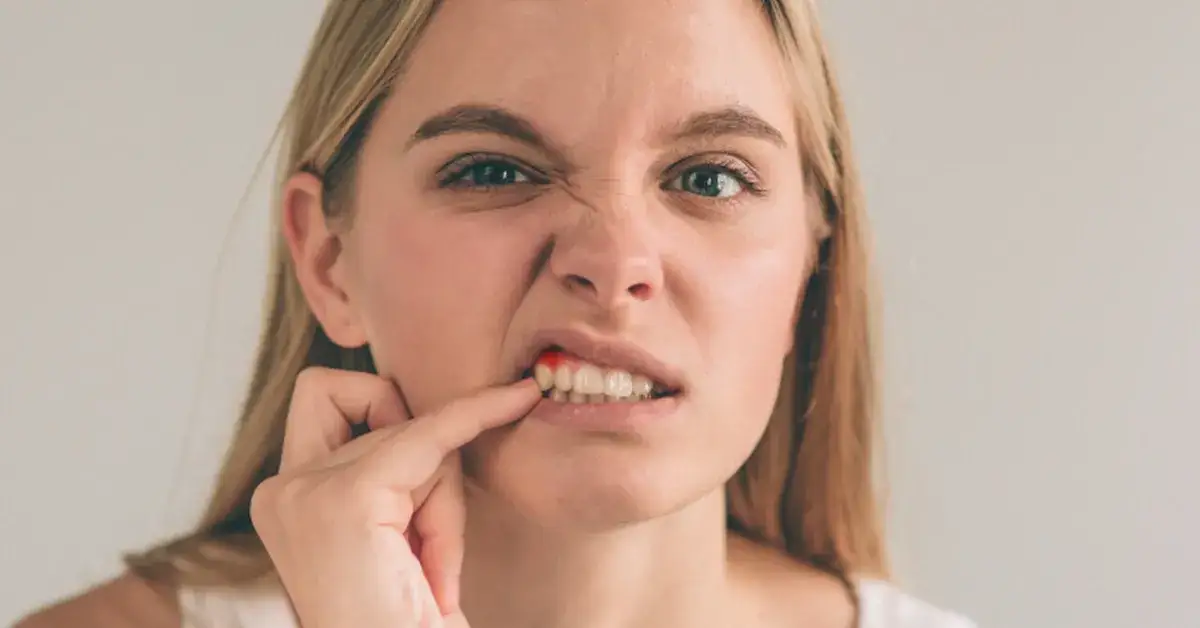 Bezpieczne sposoby na ból dziąseł w ciąży – jak złagodzić dyskomfort bez ryzyka