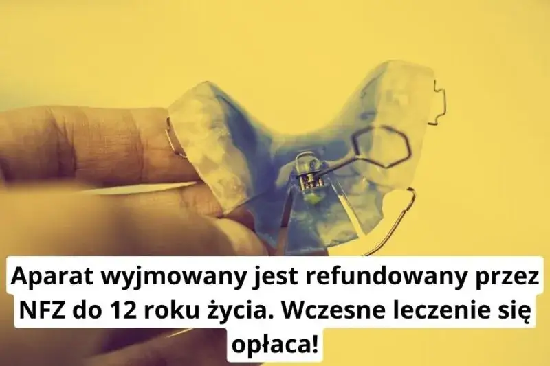 Ile naprawdę kosztuje ruchomy aparat na zęby i jak uniknąć ukrytych opłat