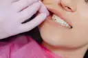 Ruszający się ząb stały? Nie wyrywaj! Pilna pomoc dentysty