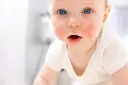 Niemowlę z zaczerwienioną wysypką na twarzy, niebieskimi oczami i otwartymi ustami.