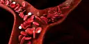 Naczynia krwionośne z prawidłowym i sierpowatym kształtem erytrocytów. Czy anemia może być ze stresu?