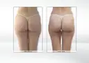 Endermologia: Ile cm stracisz? Realne efekty i wskazówki