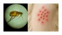Un insecto microscópico, parecido a las pulgas, y una erupción roja en la piel de un animal.