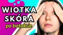 Co się dzieje z botoksem po latach? Długoterminowe skutki i zmiany