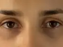 Nahaufnahme von Augen mit dunklen Ringen unter den Augen.
