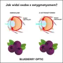 Astygmatyzm: plusy i minusy na recepcie? Zrozum swoją wadę!