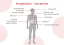 Allergie Symptome: So erkennen Sie gefährliche Reaktionen rechtzeitig