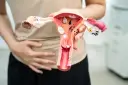 Model narządu rodnego z widocznymi zmianami, sugerującymi ciążę pozamaciczną.