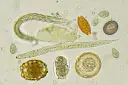 Microscopio muestra huevos y larvas de lombrices en perros. Se observan diferentes formas y tamaños de huevos, algunos con embriones.