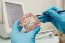 Zakładanie aparatu ortodontycznego: Bezbolesny przewodnik krok po kroku