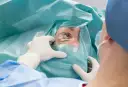 Chirurg w rękawiczkach przygotowuje oko pacjenta do zabiegu laserowej korekcji wzroku.