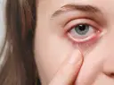 Sjögren Syndrom Diagnostik: Symptome, Tests und häufige Herausforderungen