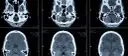 Die Bedeutung der medizinischen Diagnostik für präzise Krankheitsdiagnosen
