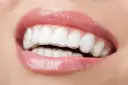 Zbliżenie na usta z błyszczącymi wargami i widocznymi, przezroczystymi nakładkami Invisalign na zębach.
