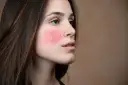 Profil einer Frau mit roten Flecken und sichtbaren Äderchen auf der Wange.