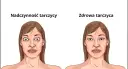 Nadczynność tarczycy objawy psychiczne - jak je rozpoznać i leczyć