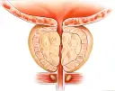 Masaż prostaty jak wykonać: bezpieczne techniki i ważne wskazówki