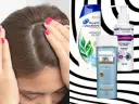 Skóra głowy z łupieżem i kilka szamponów, w tym Head & Shoulders i Pirolam, które mogą pomóc w walce z łuszczycą skóry głowy.