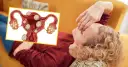 Ilustracja macicy z mięśniakami. Kobieta leży na kanapie, trzymając się za czoło. Czy mięśniaki zniknęły? Forum może pomóc.