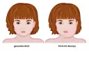 Mumps-Symptome: Erkennen, Verlauf & Komplikationen | Was tun?
