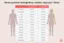 Tabela przedstawia normę hemoglobiny dla kobiet, mężczyzn i dzieci w zależności od wieku.