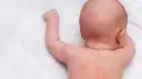 Czerwone kropki na plecach i karku maluszka to potówki u niemowlaka. Skóra jest lekko zaczerwieniona.