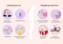 Illustration von Parkinson-Symptomen: Bewegungsverlangsamung, Muskelversteifung, Zittern, Haltungsstörung, Blasen-/Darmprobleme, Hautempfindungsstörungen, psychische und kognitive Probleme.