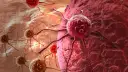 Czy wynaleziono lek na raka? Oto najnowsze informacje o terapiach