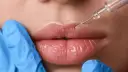Palenie po powiększaniu ust: Kiedy bezpiecznie wrócić i chronić efekt?