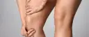 Co oznacza ból pod kolanem? Przyczyny, objawy i skuteczne leczenie