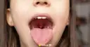 Wirus czy bakteria? Jak rozpoznać ból gardła i kiedy do lekarza?