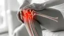Ulga w bólu kolana: Leki bez recepty, maści, suplementy. Kiedy do lekarza?