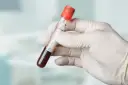 Ręka w białej rękawiczce trzyma probówkę z krwią. Na etykiecie widnieją oznaczenia t3 i t4, wskazujące na analizę parametrów.