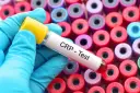 Rękawiczka w niebieskiej rękawiczce trzyma probówkę z napisem "CRP - Test" na tle wielu kolorowych probówek.