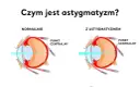 Astygmatyzm: Kiedy do okulisty, a kiedy do optometrysty?