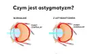Astygmatyzm: Wyleczyć czy skorygować? Przewodnik po metodach.