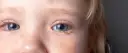 Ropiejące oczko u niemowlaka: Co robić, czego unikać i kiedy do lekarza
